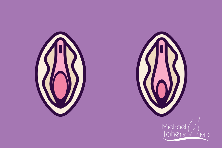 Tight Vagina During Sex